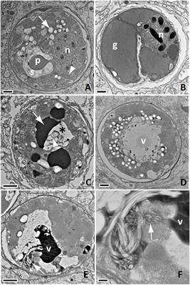 Viral-Like Particles Are Associated With Endosymbiont Pathology in Florida Corals Affected by Stony Coral Tissue Loss Disease